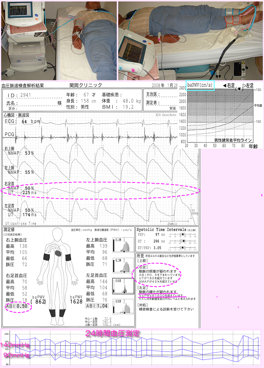 動脈硬化・血管狭窄検査