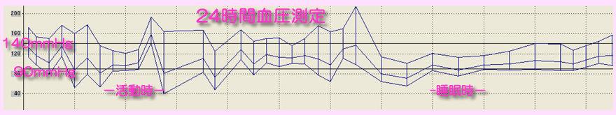 高血圧の24時間血圧記録による評価